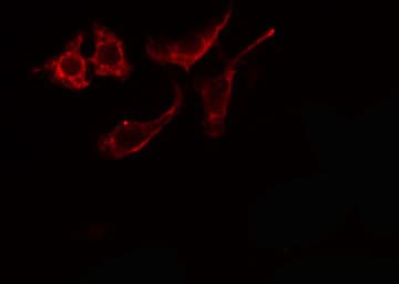 ARSE / Arylsulfatase E Antibody