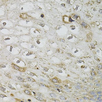 Polyclonal Rabbit anti-Human SERPINA1 / Alpha 1 Antitrypsin Antibody (IHC, IF, WB)