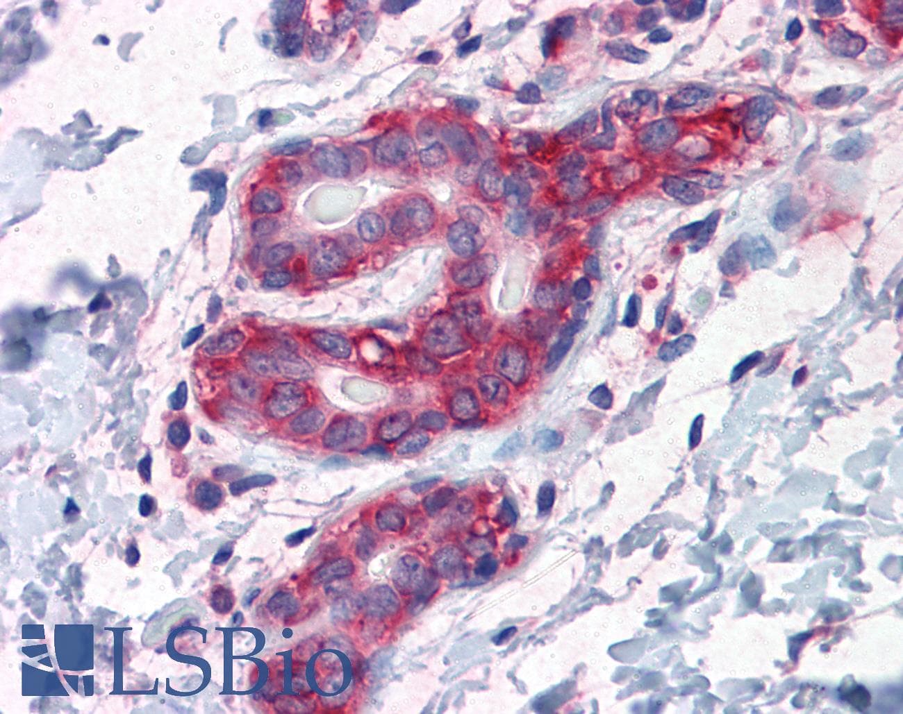 IHC-plus™ Monoclonal Mouse anti-Human G3BP1 / G3BP Antibody (clone 2F3, IHC, IF, WB)