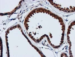GATM / AGAT Antibody (clone OTI1E3, Carrier-free)