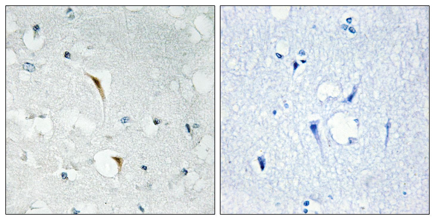 RBM6 / 3G2 Antibody