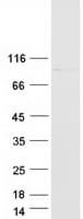 Human GLE1 Protein (Recombinant Myc-DDK (Flag))