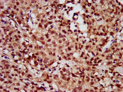 HIST1H3A Antibody