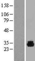 PHOSPHO1 Protein (Over-Expression Lysate Myc-DDK (Flag))