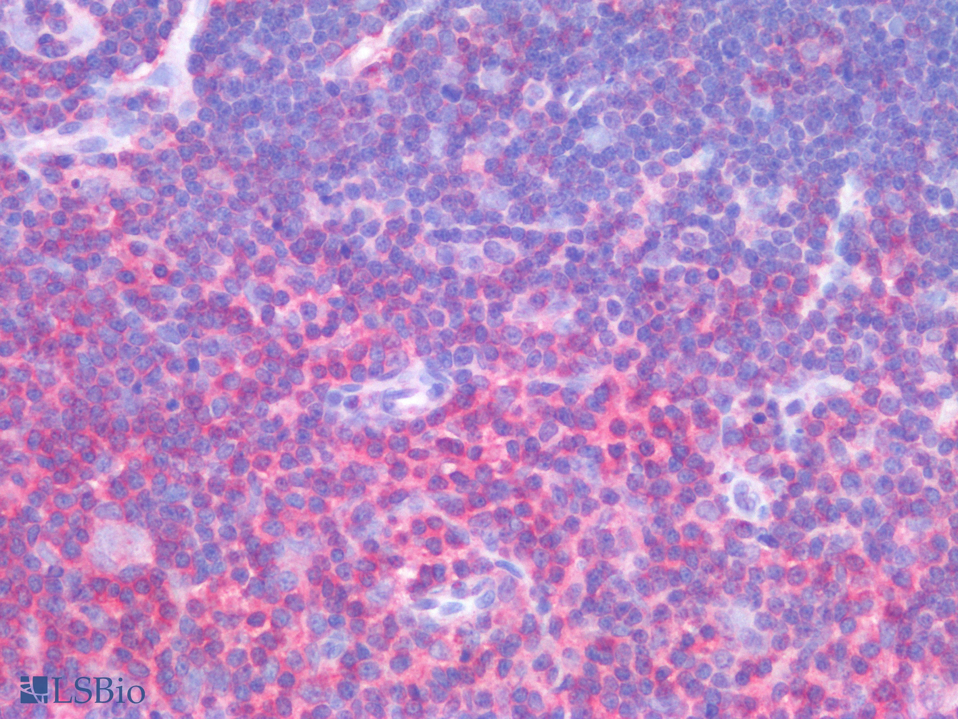 PathPlus™ PTP1B Antibody