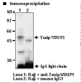Monoclonal Mouse anti-Human TXNIP Antibody (clone JY2, WB)