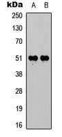 Polyclonal Rabbit anti-Human Vitamin D Receptor / VDR Antibody (phospho-Ser208, IF, WB)