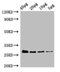 Polyclonal Rabbit anti-Human RPS2 / Ribosomal Protein S2 Antibody (HRP, IHC, WB)