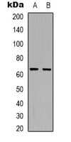 Polyclonal Rabbit anti-Human ARSI / Arylsulfatase I Antibody (Internal, WB)