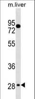 Polyclonal Rabbit anti-Human TEF Antibody (aa213-240, WB)