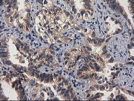 GBA3 / CBG Antibody (clone OTI1F1)