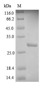Human HLA-DQB1 Protein (Recombinant 6His, N-terminus)