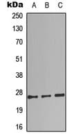 Complement C1QB Antibody (C-Terminus)