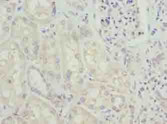 GLS / Glutaminase Antibody