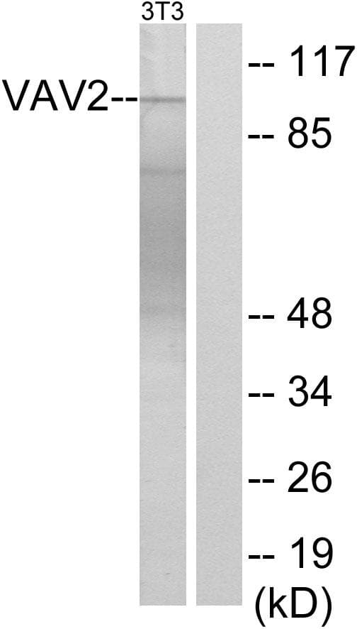 Polyclonal Rabbit anti-Human VAV2 Antibody (p142, IHC, IF, WB)