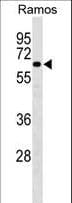 SAS6 / SASS6 Antibody (aa325-352)