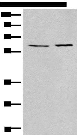 USP14 Antibody