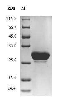 Escherichia coli loiP Protein (Recombinant 6His, N-terminus)