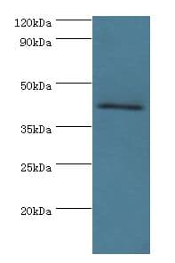 VIPERIN / RSAD2 Antibody (aa42-361)