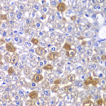 Polyclonal Rabbit anti-Human MYO1C Antibody (IHC, IF, WB)