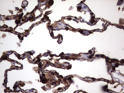 KRT19 / CK19 / Cytokeratin 19 Antibody (aa240-390, clone OTI5G7)