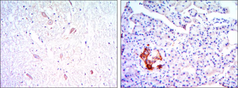 Monoclonal Mouse anti-Human KLHL13 Antibody (clone 8D1, IHC, IF, WB)