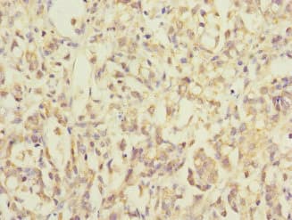 Polyclonal Rabbit anti-Human MRPL12 Antibody (IHC)