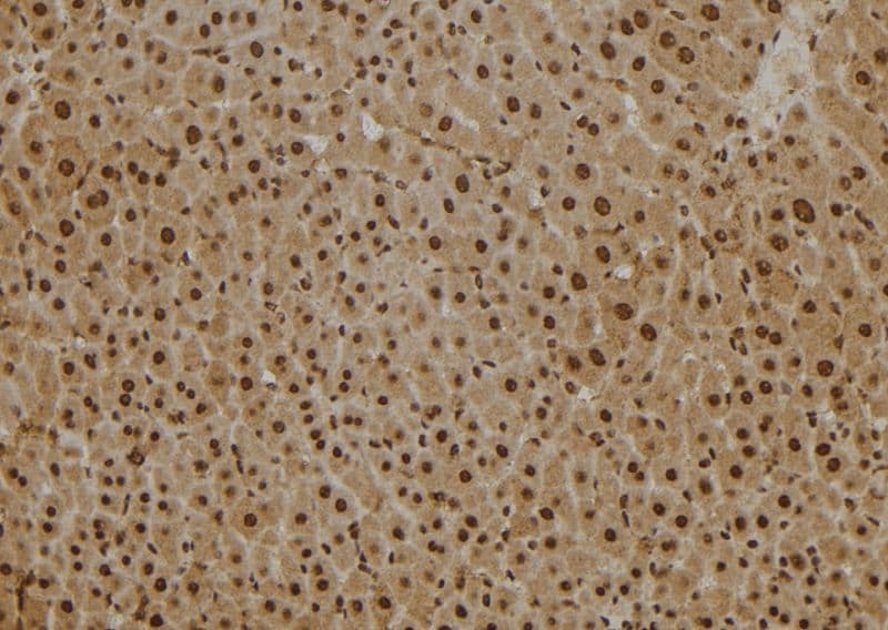 PSMB2 Antibody