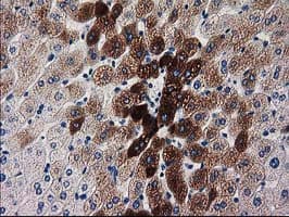 Monoclonal Mouse anti-Human KATNAL1 Antibody (clone OTI1A7, IHC, WB)