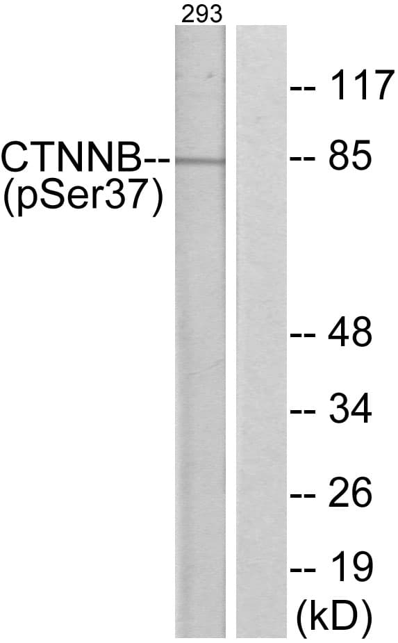 CTNNB1 / Beta Catenin Antibody (phospho-Ser37)