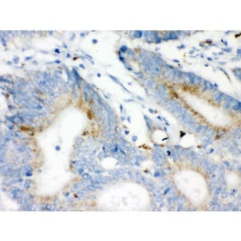 VDAC1 / PORIN Antibody (aa154-181)