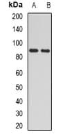 H6PD / G6PDH Antibody