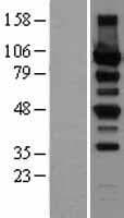 PRKD2 / PKD2 Protein (Over-Expression Lysate Myc-DDK (Flag))