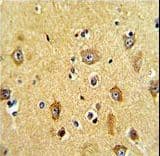Polyclonal Rabbit anti-Human PPP2R2B Antibody (aa104-130, IHC, IF, WB)