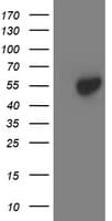ACY1 / Aminoacylase 1 Antibody (clone OTI2D3)