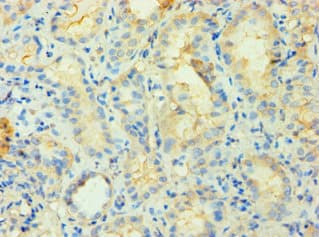 Polyclonal Rabbit anti-Human PIP4K2B Antibody (aa1-270, IHC, WB)