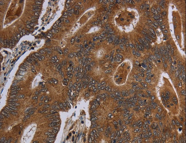 HSD17B13 Antibody