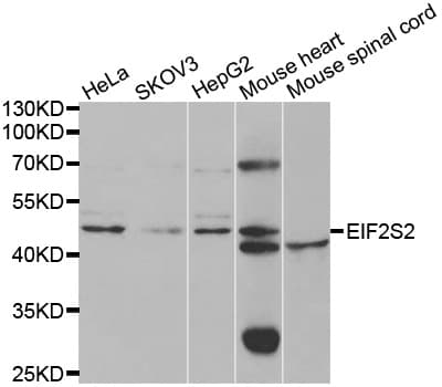 EIF2S2 Antibody