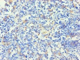 KRT14 / CK14 / Cytokeratin 14 Antibody (aa1-472)