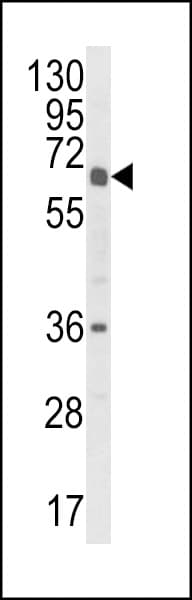 CYP2C18 / CYP2C Antibody (aa448-478)