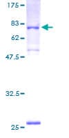Human PCYOX1 Protein (Recombinant GST)