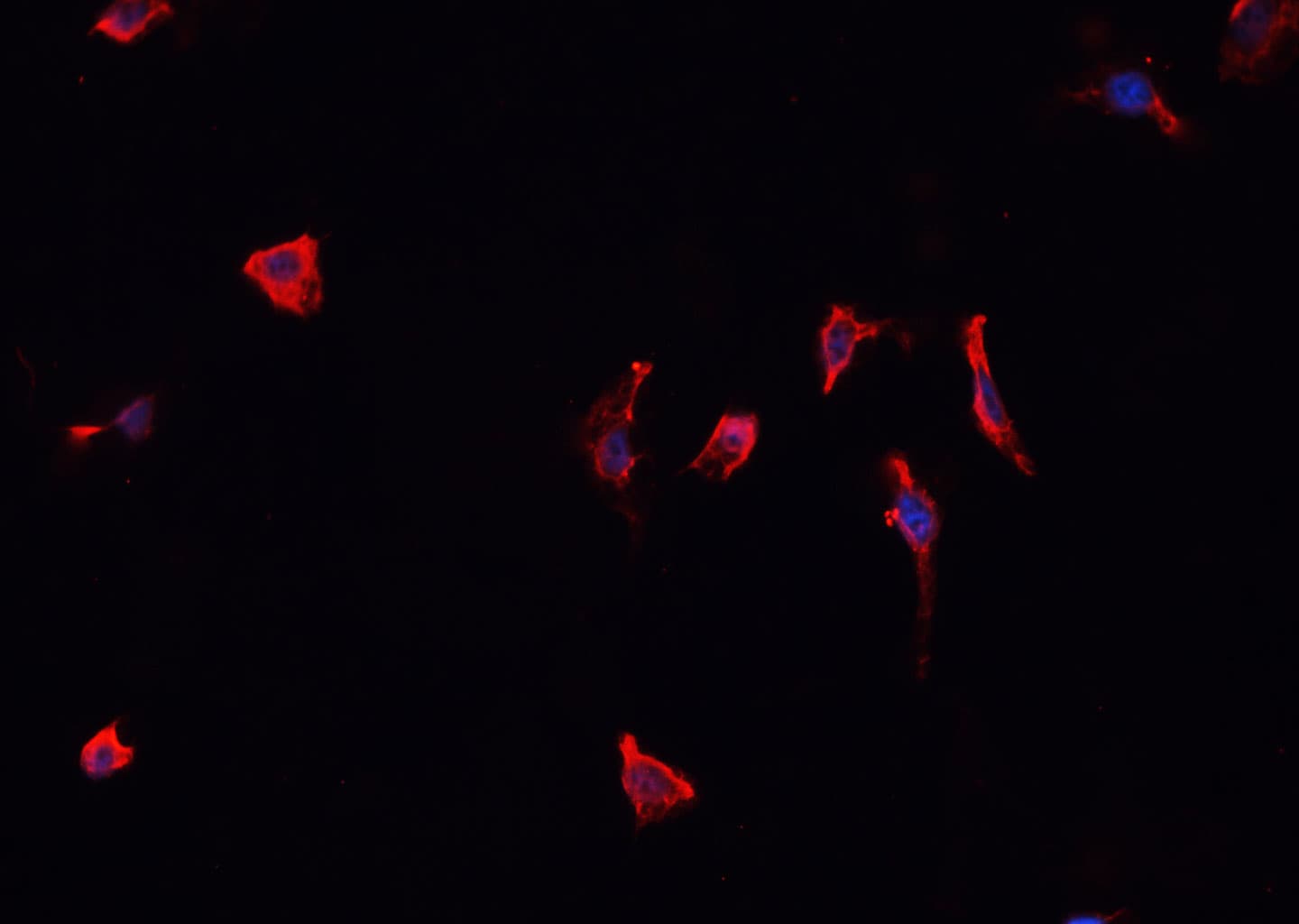 CARD6 Antibody