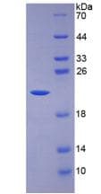 Human IL7 Protein (Recombinant His-T7)