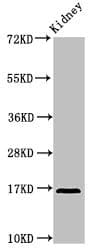 IL36RN / IL1F5 Antibody (aa1-155)