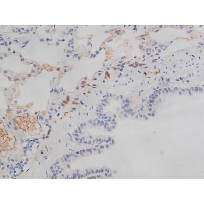 MAPT / Tau Antibody (phospho-Ser214)