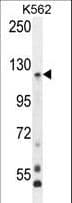 Polyclonal Rabbit anti-Human PCDHGA8 Antibody (aa781-808, IHC, IF, WB)