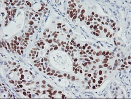 TP53 / p53 Antibody (clone OTI3A6)