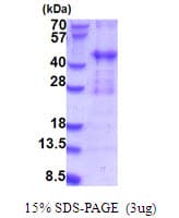 Human PIH1D2 Protein (Recombinant His)