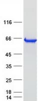 Human BCO1 / BCMO1 Protein (Recombinant Myc-DDK (Flag))