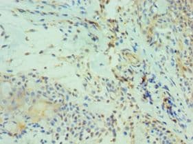 Polyclonal Rabbit anti-Human CDH13 / Cadherin 13 Antibody (aa120-370, IHC)